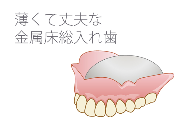 薄くて丈夫な金属床総入れ歯